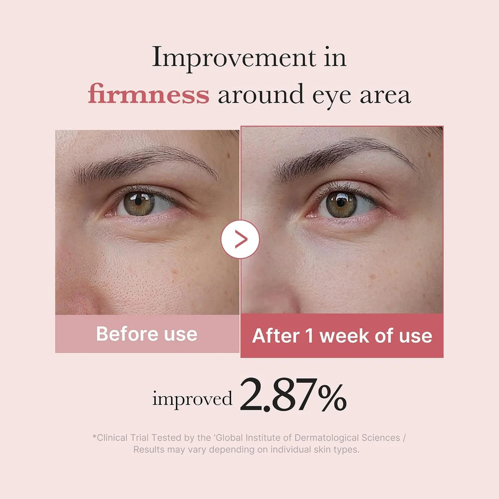 Salmon DNA Retinol Eye Serum