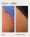 Topicals High Roller Ingrown Hair Serum
