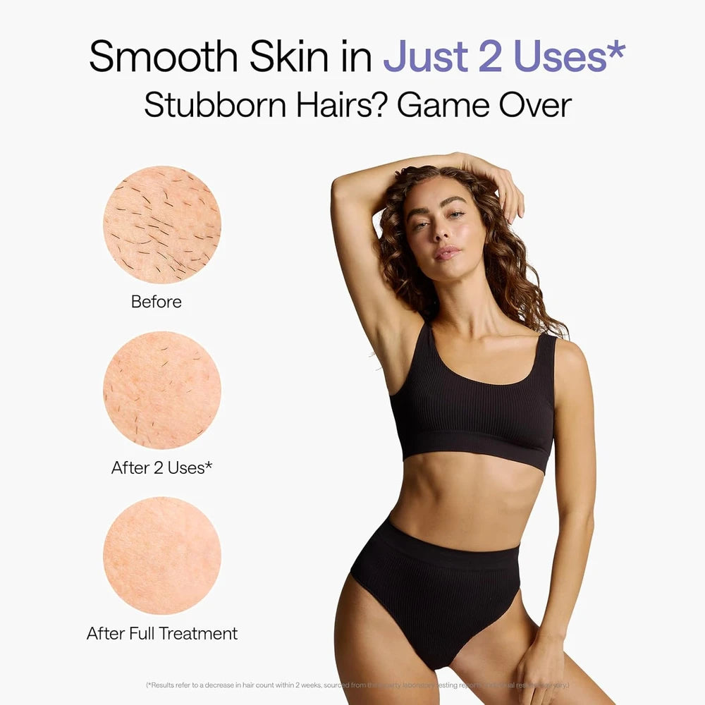 Ulike Air 10 IPL Hair Removal Device