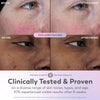 Olay Super Serum